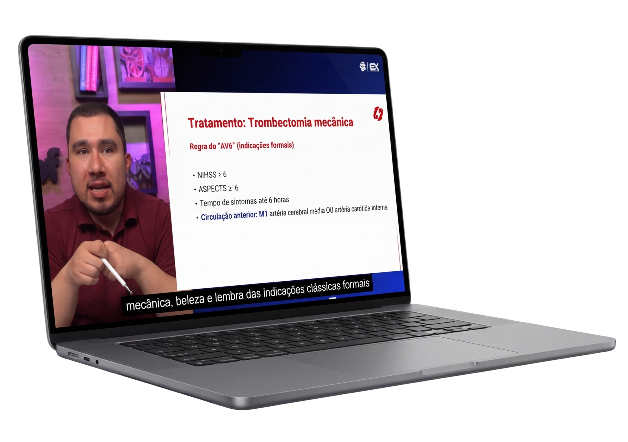 Plataforma MedCof — AVC Isquêmico